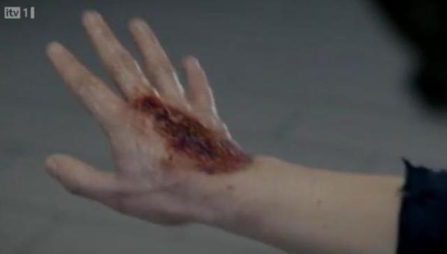 Primeval - S4x04 - Hand is affected!!