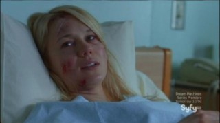 Being Human S2E13 Nora road rash