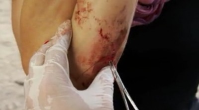 Destination Truth S4x12 Ryder getting stitches