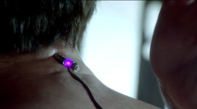 Fringe S5x05 - Peter implants the Observer's device in his own head, crazy