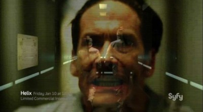 Helix S1x01 - Neil Napier as Peter Farragut infected at the Arctic Biosystems lab