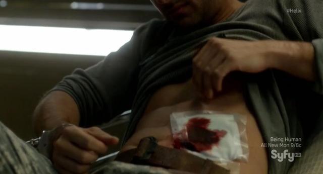 Helix S01x08 Sergio suffers a wound