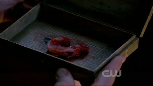 Supernatural S7x15 - Noras sons ear