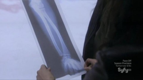 Warehouse 13 S4x05 x rays Mike